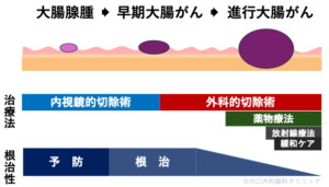 大腸がんの進展・治療法・根治性について